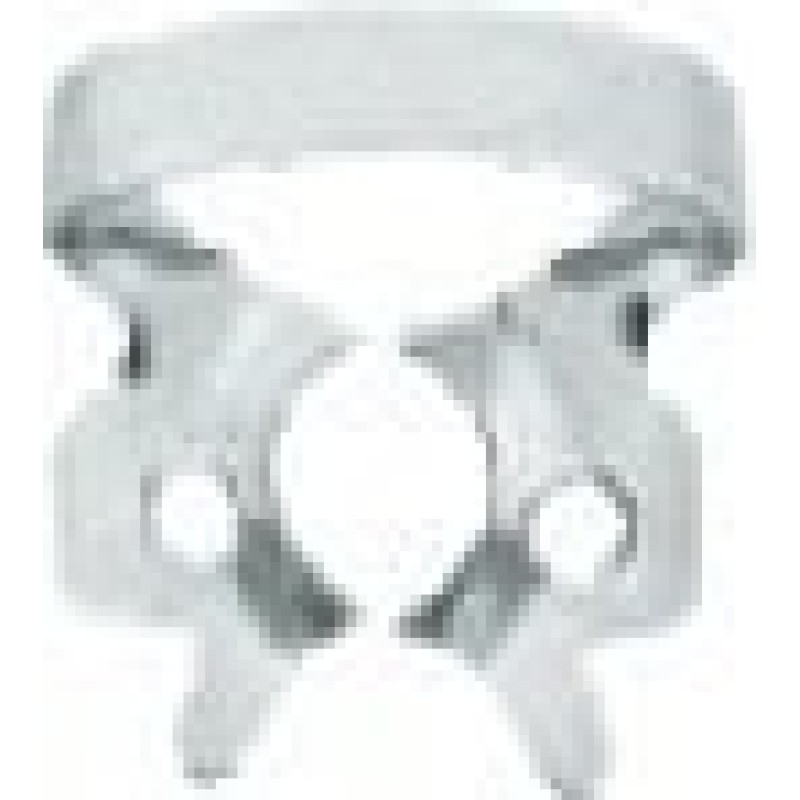 Rubber Dam Clamp,